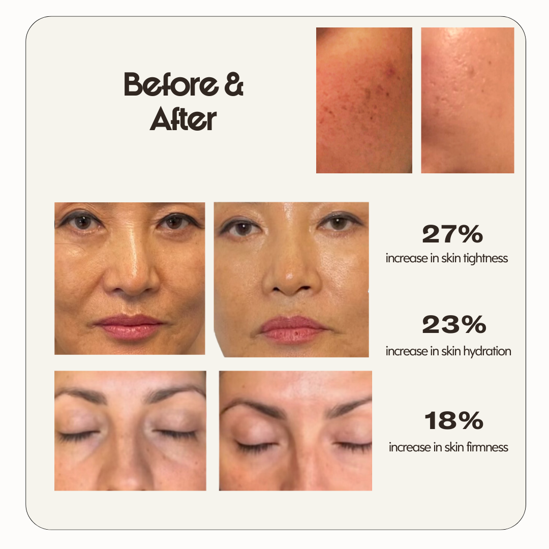 Milky Rose & Honey Marine Collagen