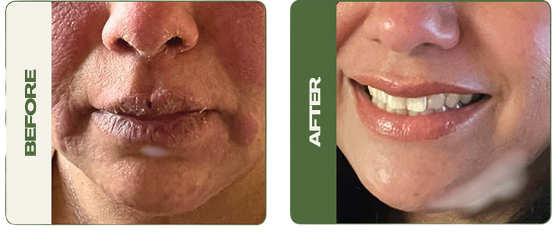 Before After transformation